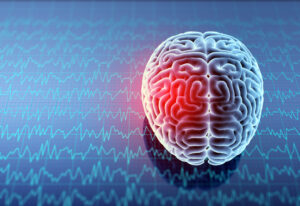 How The King Firm Car Accident and Personal Injury Lawyers Can Help After a Brain Injury in Waycross